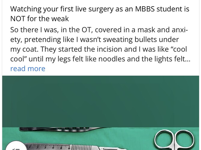 La imagen presenta una sección detallada de la narrativa en primera persona de un estudiante de MBBS sobre el seguimiento de una cirugía en vivo, expresando su calma y compostura iniciales antes de sentir una intensa ansiedad durante el procedimiento, con instrumentos quirúrgicos y de medición acompañantes. (Subtitulado por IA)